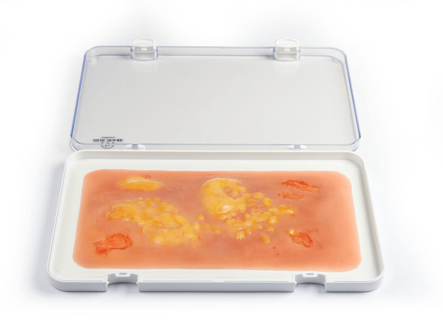 Wundmoulage Brandwunde 2. Grades - Erler - Zimmer